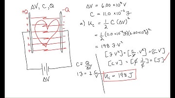 Example: A Defibrillator is a Capacitor