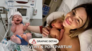 MY DETAILED BIRTH STORY | BREECH BABY C-SECTION