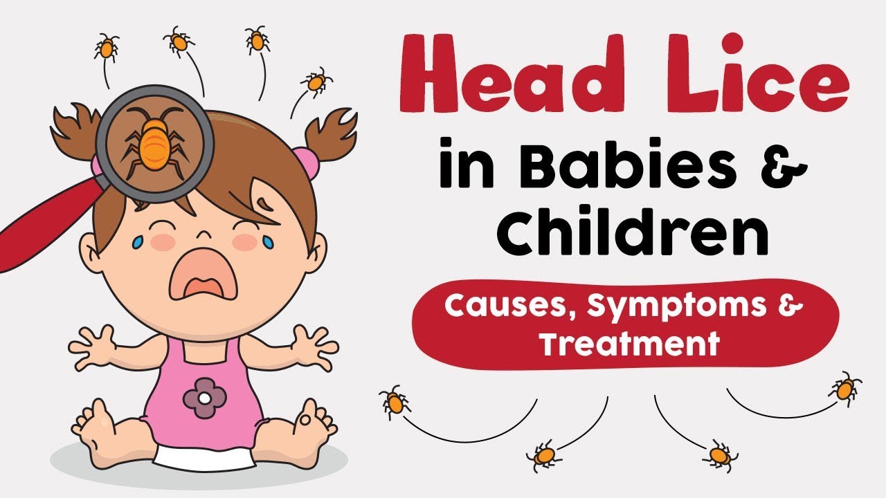 Head Lice In Babies And Children Causes Signs And Remedies Youtube