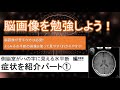無料で簡単！脳画像の勉強「側脳室がハの字に見える　水平断編　症状紹介part①」【超簡単解説】