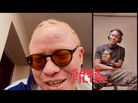 Unfiltered with Balthazar DY