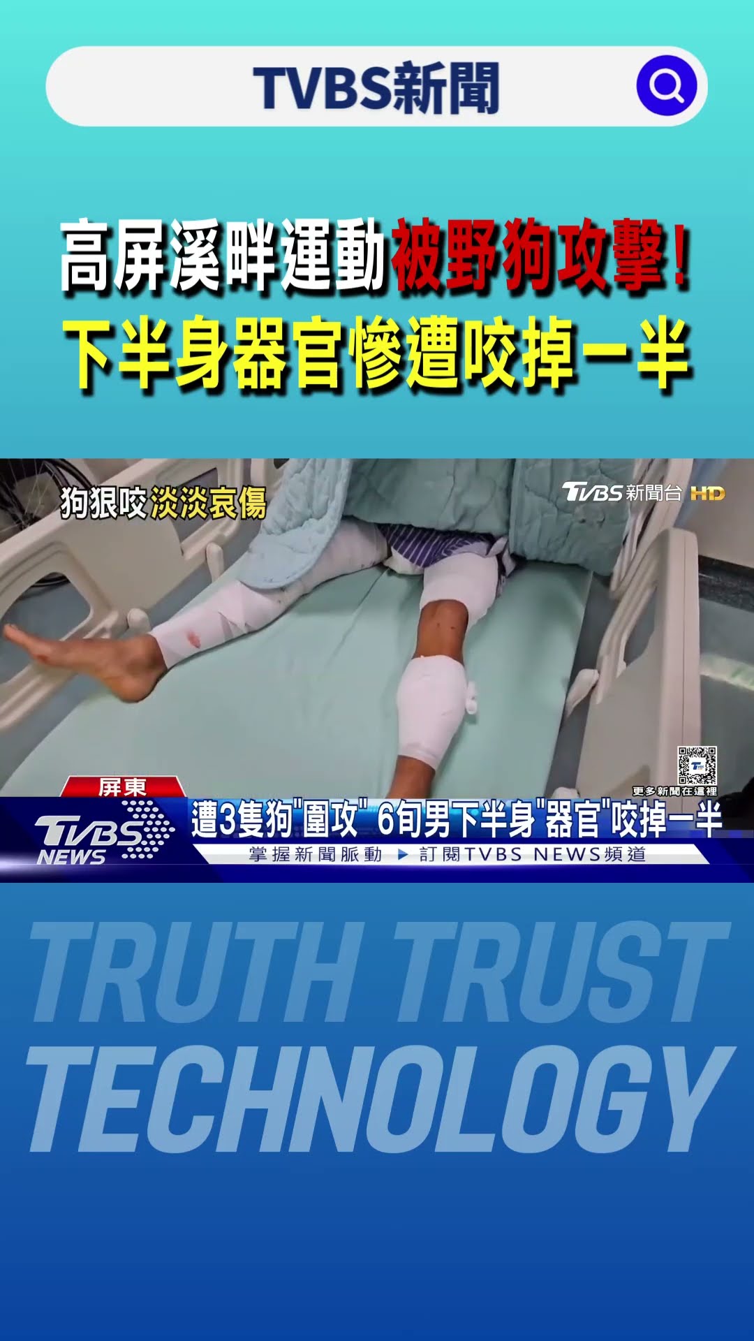 高屏溪畔運動被野狗攻擊! 下半身｢器官｣慘遭咬掉一半｜TVBS新聞 @TVBSNEWS01