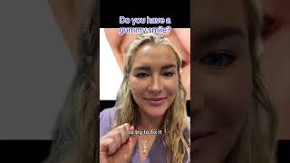 4 ways to fix gummy smile featuring 1