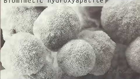 Immobilised Hydroxyapatite and Collagen Coating on Metallic Implant