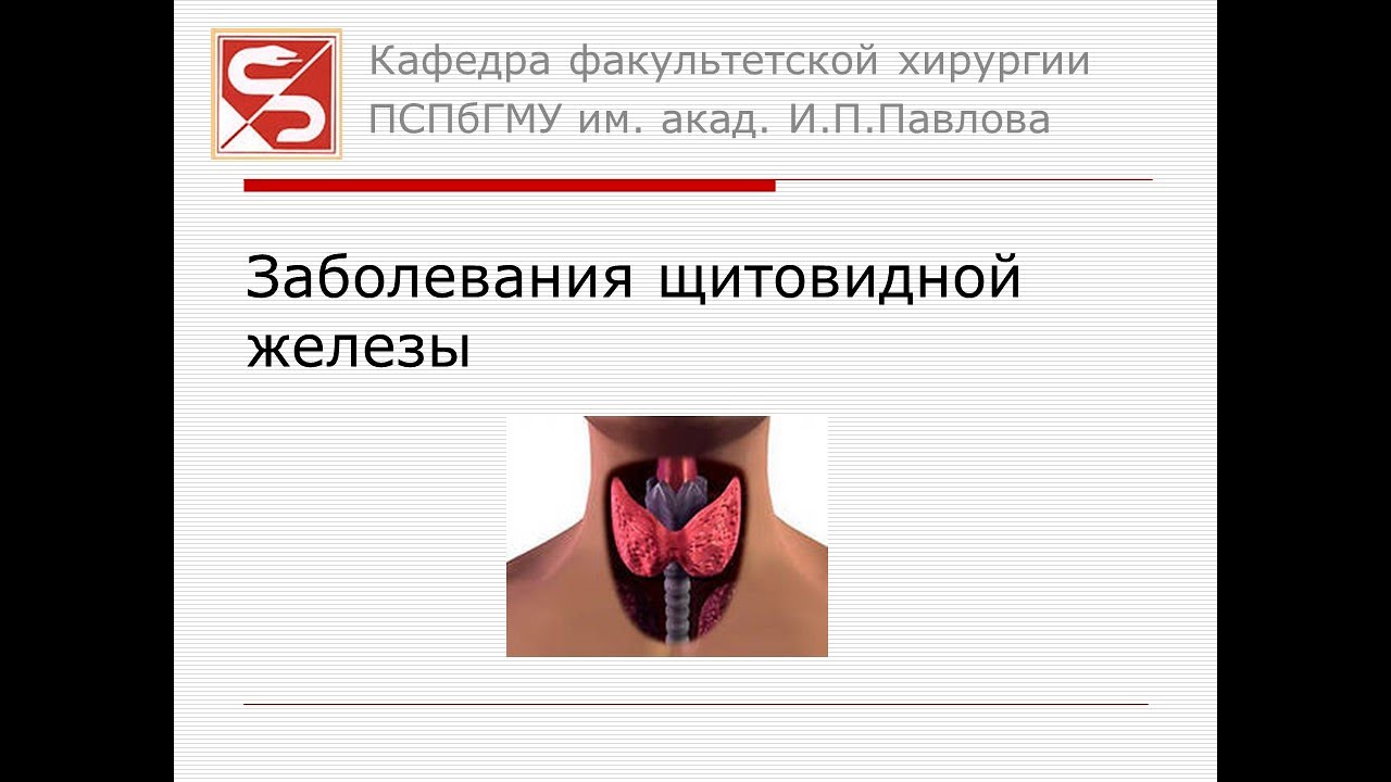 Заболевания щитовидной железы хирургия презентация
