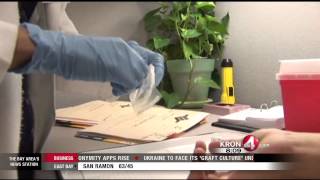 Santa Clara County Tuberculosis Cases on the Rise