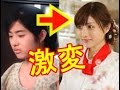 【裏芸能】あのアイドルも？女優の整形の真相 劣化の噂も 揉み消し切れない過去