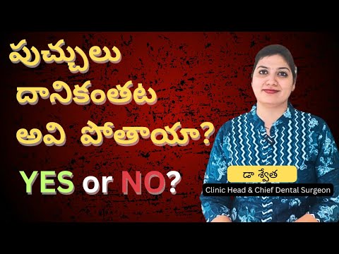 పుచ్చులు దానికంతట అవి పోతాయా? Can Teeth Cavities Go Away on Their Own in Telugu | Dr Swetha