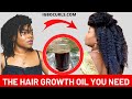 DIY Homemade Hair Growth Oil for Fast Growth and Thickness in 4c Natural Hair