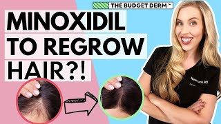 Minoxidil For Hair Loss | Everything you need to know!