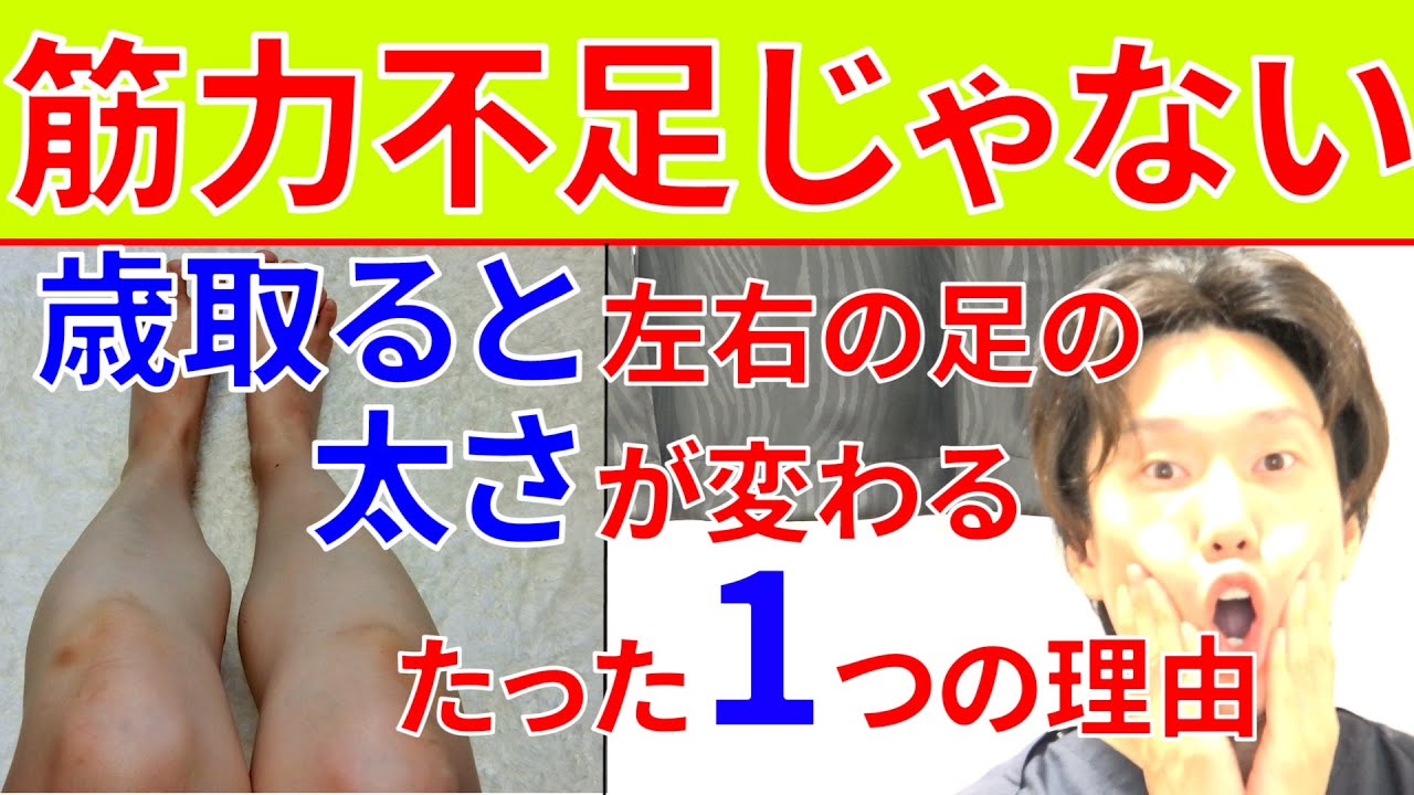 左右 の 太もも の 太 さ が 違う 病気