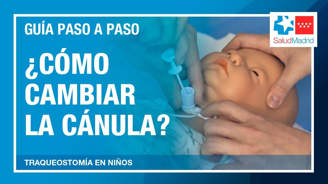 ¿Cómo cambiar la cánula de traqueostomía en niños? | Hospital Gregorio Marañón