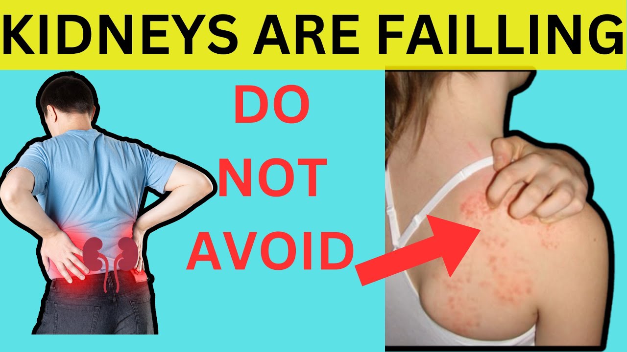 10 signs your kidneys are crying for help youtube
