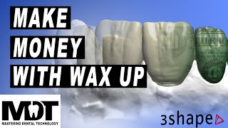 How to make money with a Wax-Up [ 3 shape wax-up Design and Model Builder Tutorial for Success ]