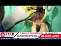 Fistula in ano laser surgery live operation how its done bhagandar ka laser se ilaaj kese hota hai