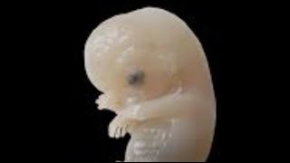 Berdoa agar IVF diakhiri karena Jutaan Embrio Manusia Terus Mati
