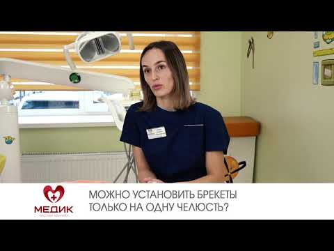 Можно установить брекеты только на одну челюсть?