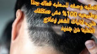 وصفه ممتازه لعلاج  ثعلبه وصفه لعلاج الثعلبه بطريقه سهله جدا