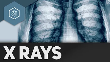 In welchen Bereichen werden Röntgenstrahlen eingesetzt?