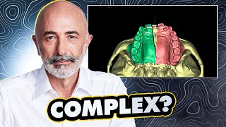 Complex planning to keep all teeth by Dr Paul Coceancig 886 views 5 months ago 56 minutes