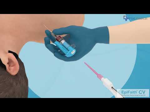 EpiFaith - CV: Techniques Explained and FAQ - video from Flat Medical