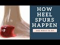 HUGE Heel Bone Spur Cause | How To Prevent Them And Reduce Pain & Exercises To Do!