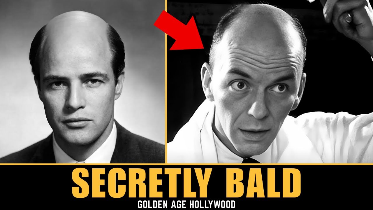 15 Golden Age Stars Who Were Actually Bald But Wore Wigs