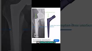 Separated File Outside The Root C