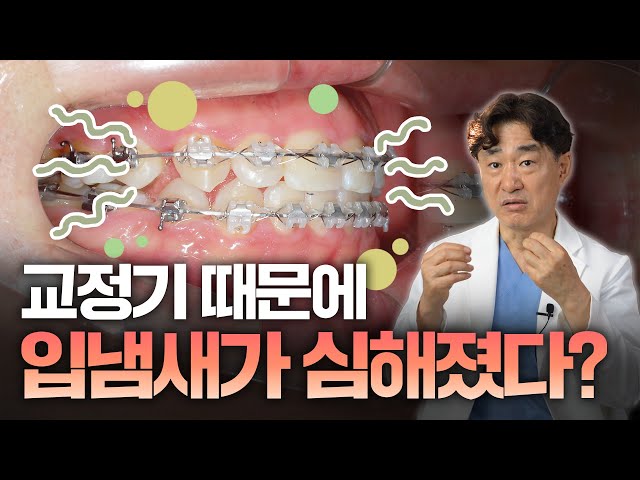 교정을 시작하니 입냄새가 심해졌다? 정말 교정 때문일까요?