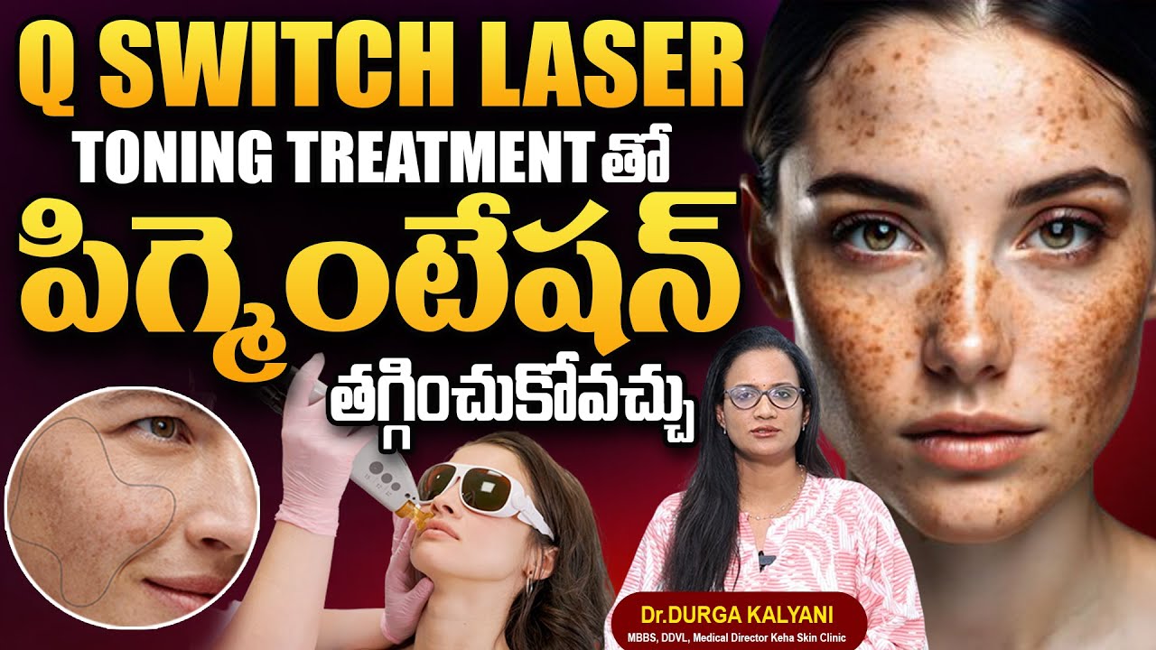 PIGMENTATION - Q Switch Laser Treatment తో మంగుమచ్చలు తగ్గించుకోవచ్చు..| Dr. Durga Kalyani | SumanTv