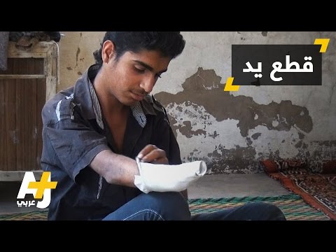 تنظيم الدولة يقطع يد مراهق بتهمة السرقة