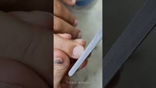 Transformación en uñas mordidas