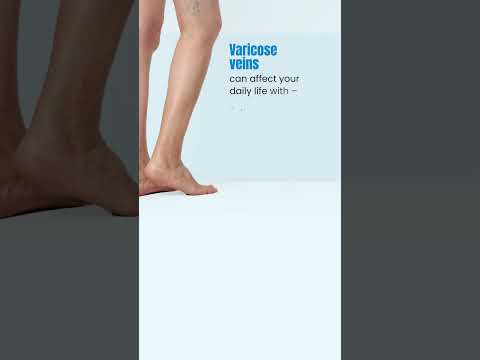 Effective Varicose Veins Treatment | Regain Healthy Legs with PSRI Hospital Vascular Care
