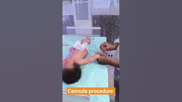 Thumbnail of #cannula #procedure #nicubaby #doctor #hospital #viralvideo #shortvideo #song #love #newbornbaby