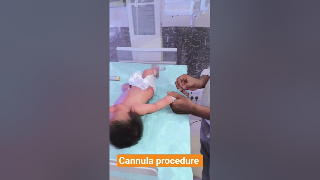 #cannula #procedure #nicubaby #doctor #hospital #viralvideo #shortvideo #song #love #newbornbaby