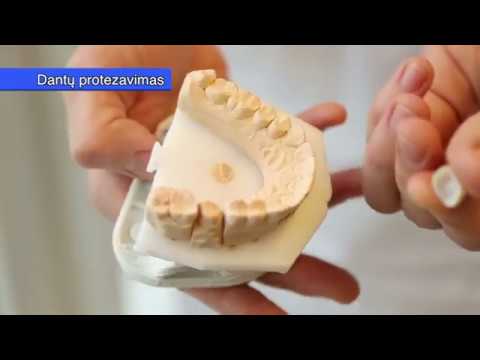 Video: Dantų Protezavimo Tipai