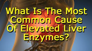 What Is The Most Common Cause Of Elevated Liver Enzymes?