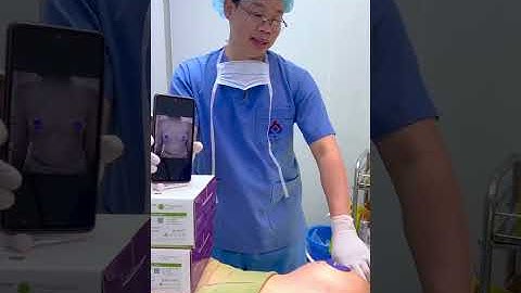 Kết quả sau 30 phút nâng ngực không nghỉ dưỡng | Ths. bs Bùi Văn Cường