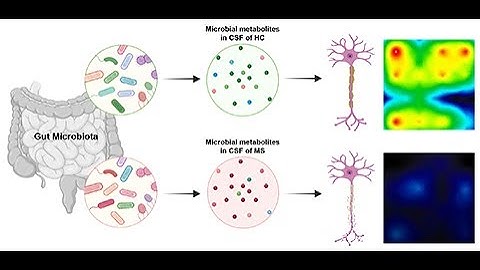 Bacterial neurotoxic metabolites in multiple sclerosis cerebrospinal fluid and plasma