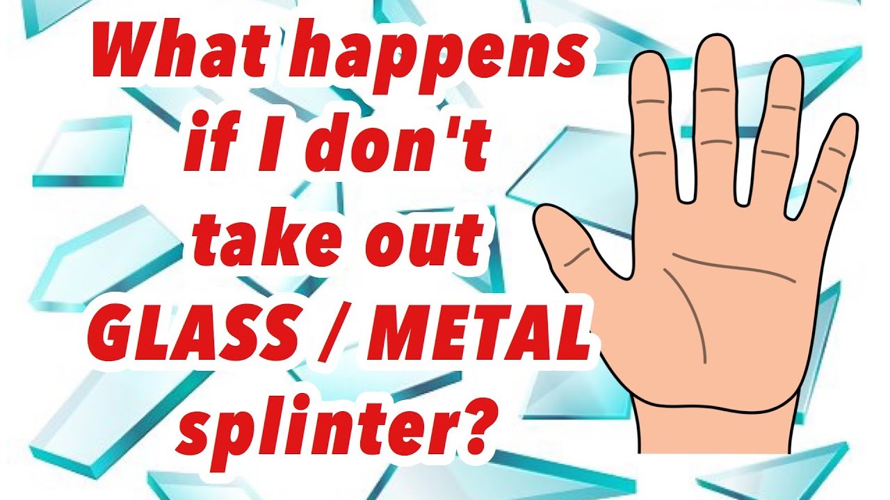 Should I Leave A Glass Splinter In? Can I Leave A Metal Splinter In? What Happens If I Leave It In?