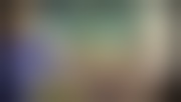 compilation video: dense cataract surgery techniques