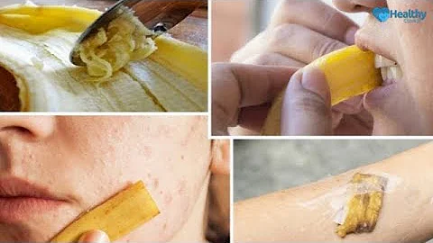 You Will Never Throw Away Banana Peels After Watching This - Healthy Channel