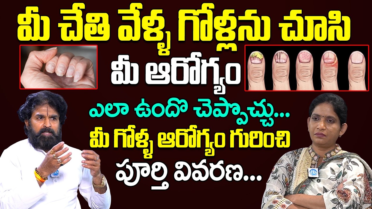 మీ గోళ్ళు ఇలా ఉన్నాయా ? | Vikaram Aditya About Nail Problems and Symptoms || iDream Health Tips