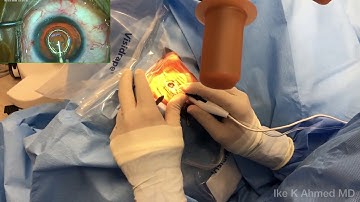 Dr Ike Ahmed Training Video Zepto