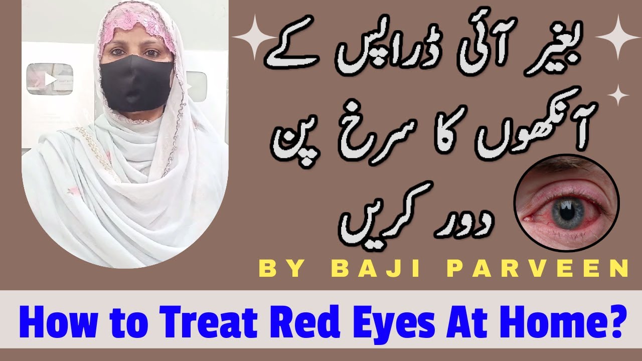 Contact lens acute red eye treatment - Lal Ankho Ka Ilaj Ghr Ki Remedy