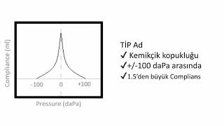 Timpanogram Tipleriti̇mpanogram Yorumlama