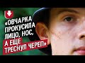 Овчарка укусила меня за лицо: Антон | Быть молодым