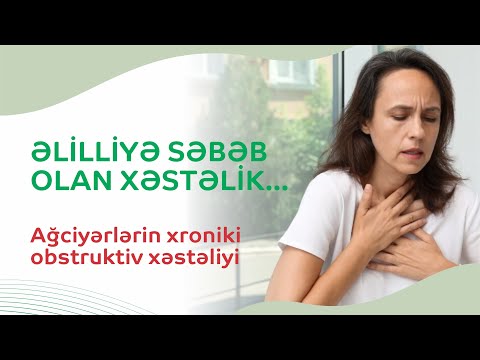 Video: Xroniki İltihabi Demiyelinizan Polinevropatinin (CIDP) Müalicəsinin 3 Yolu