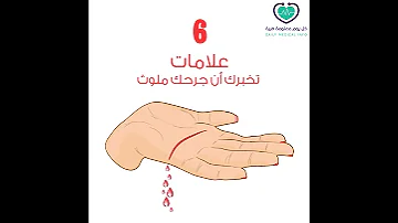 كيف تعرف أن جرحك ملوث 