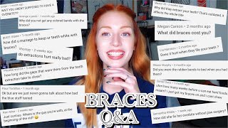 Reading YOUR Comments! POST-BRACES Q&amp;A | Ashenlife